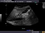 A Gallery of High-Resolution, Ultrasound, Color Doppler & 3D Images
