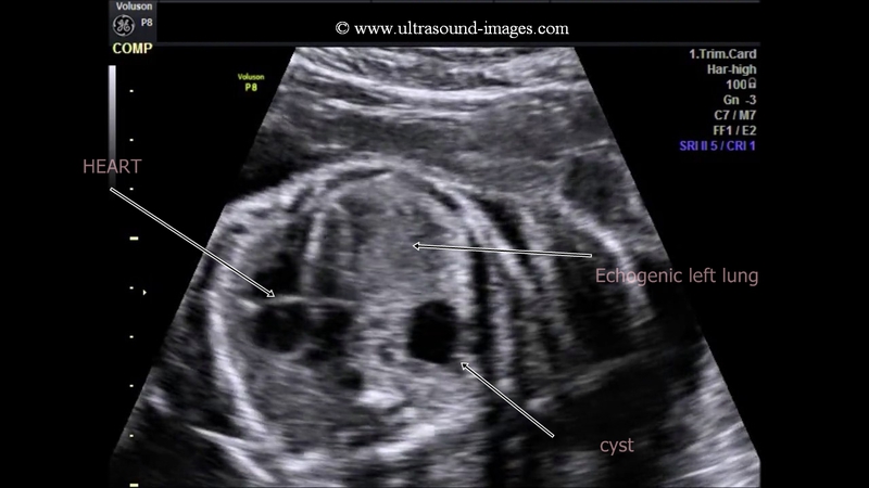 A Gallery Of High Resolution Ultrasound Color Doppler 3D Images A Gallery Of High Resolution Ultrasound Color Doppler 3D Images