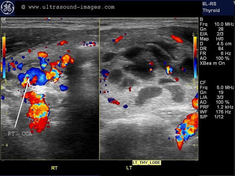 A Gallery of HighResolution, Ultrasound, Color Doppler