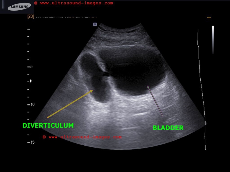 A Gallery of High-Resolution, Ultrasound, Color Doppler ...
