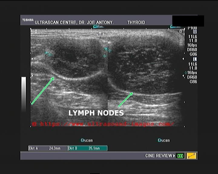 A Gallery of High-Resolution, Ultrasound, Color Doppler & 3D Images