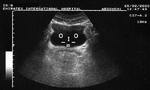 bladder-cat