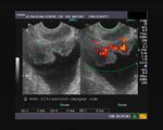 RUS ultrasound images of the prostate and bladder