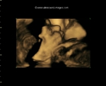3D fetus in profile