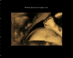 3D fetus in profile