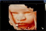 fetal face with open eyes
