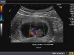 early-fetus-1c