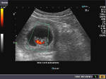 early-fetus-1f