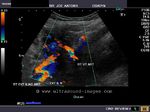 uterine-artery